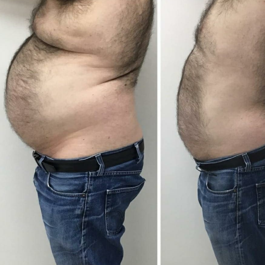 Aesthetiq TURBO FIT - NEW FORMULA KIT